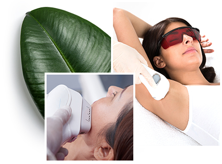 haarentfernung-laser